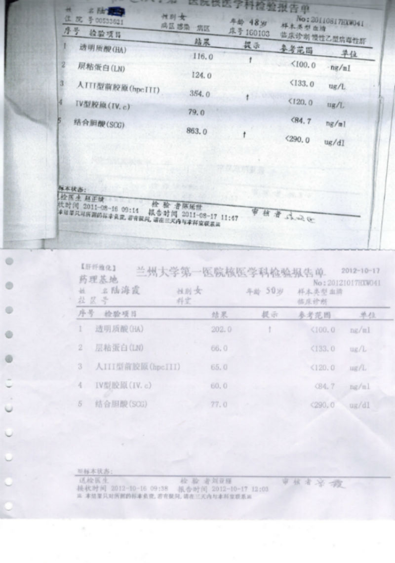 肝硬化 杨某某                       肝纤维化5项是检验肝脏纤维化